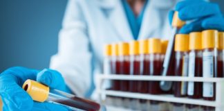 blood-thinning-foods